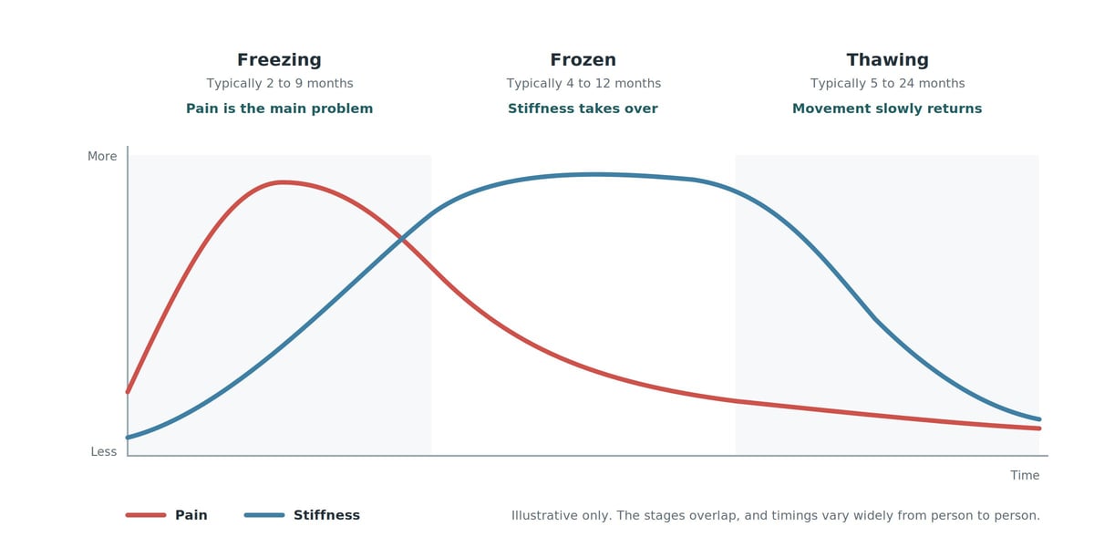 Line graph showing pain and stiffness levels over time through the freezing, frozen and thawing phases of a frozen shoulder